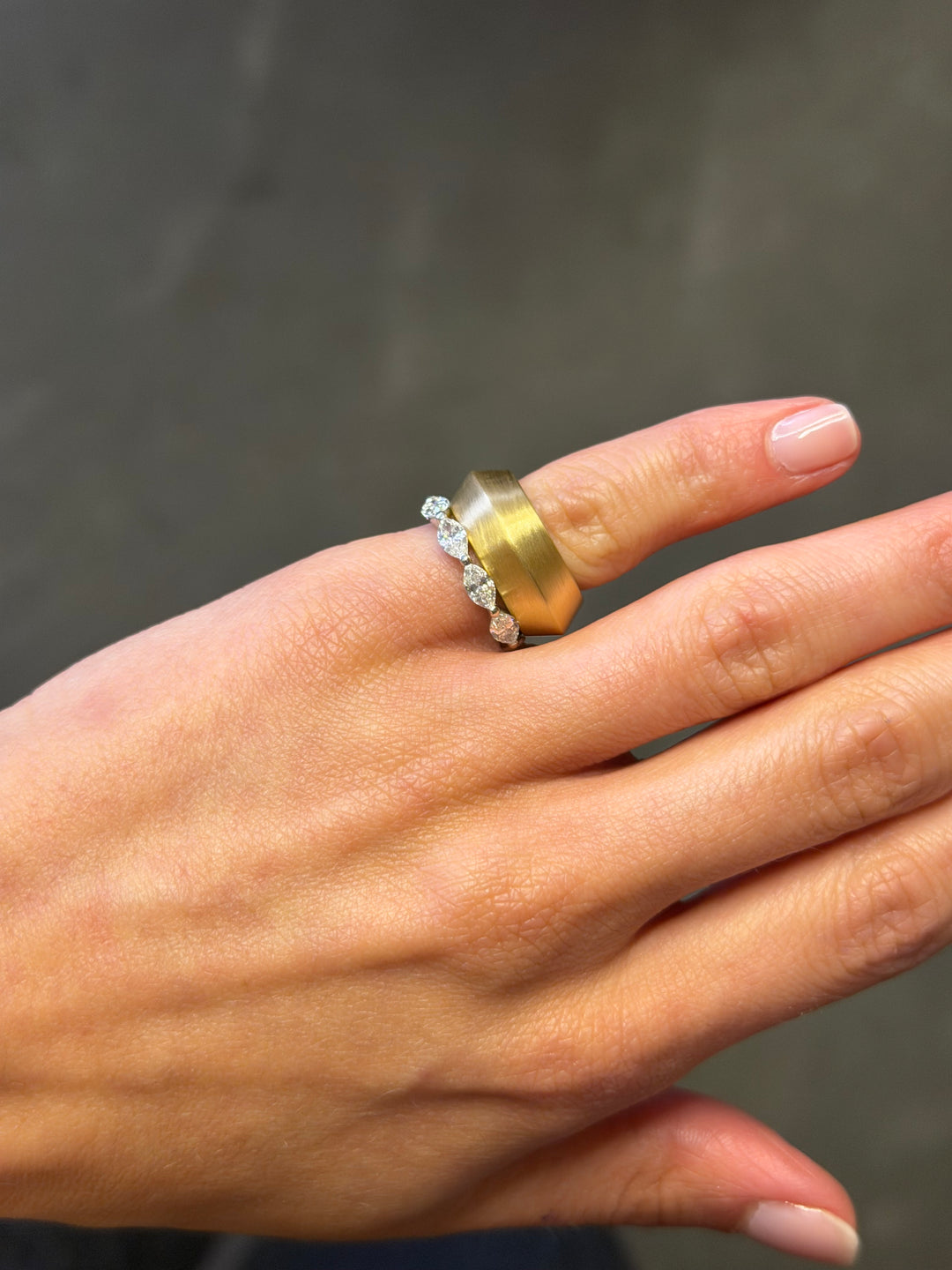Core Ring